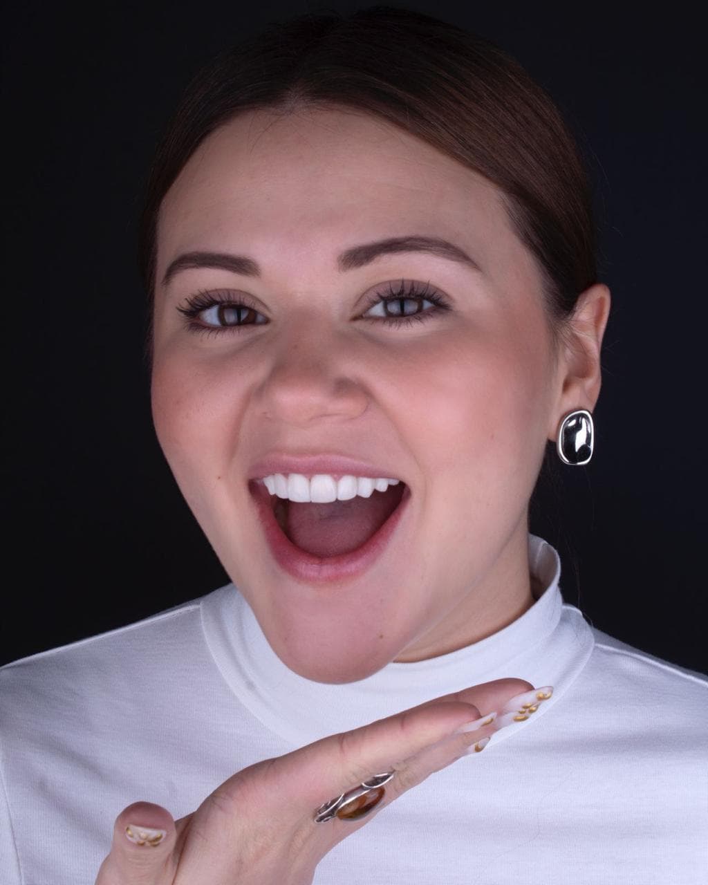 Paciente mostrando su nueva sonrisa